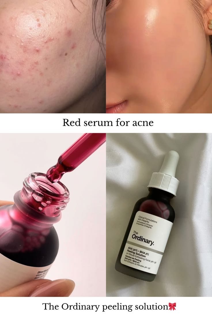 The Ordinary AHA 30% + BHA 2% Peeling Solution 30ml